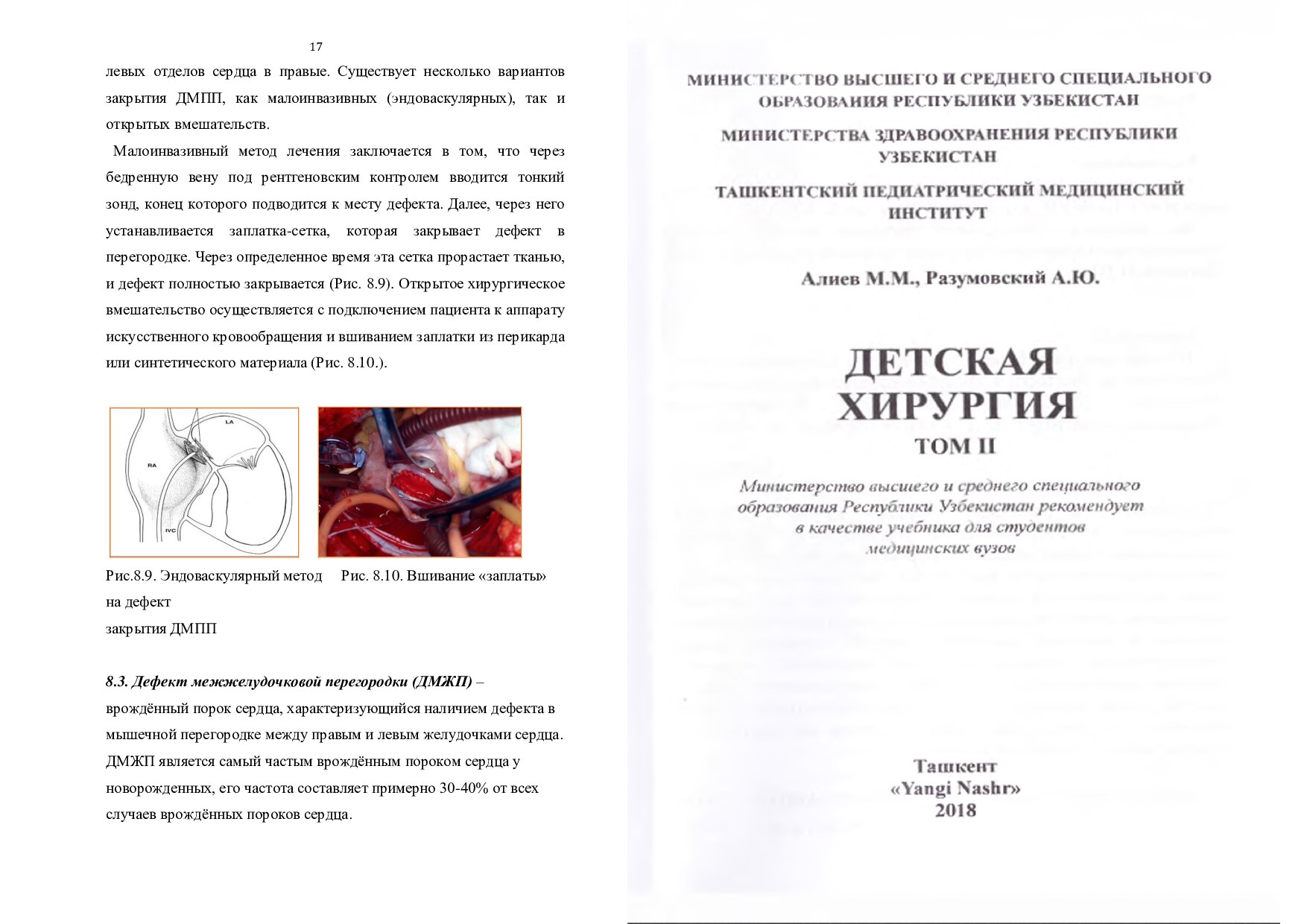 детская_хирургия_алиев_2_том_ПЕЧАТЬ (2)