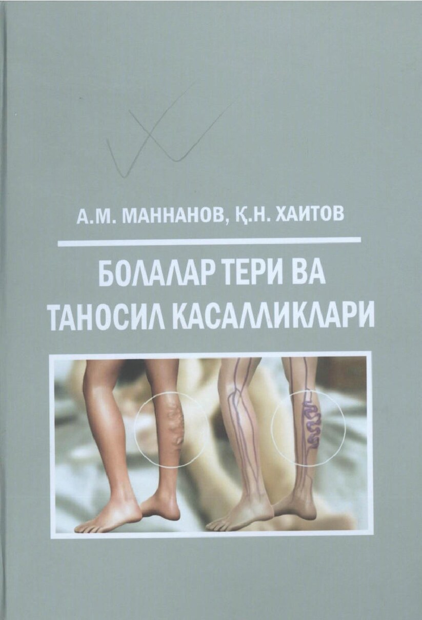 Болалар тери ва таносил касалликлари