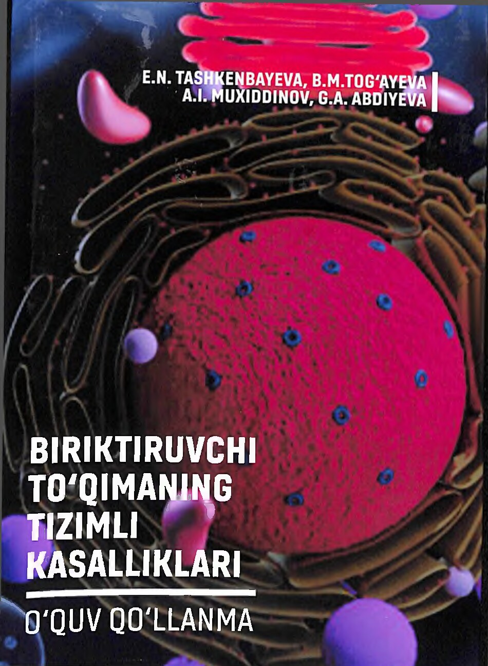 Biriktiruvchi toqimaning tizimli kasalliklari