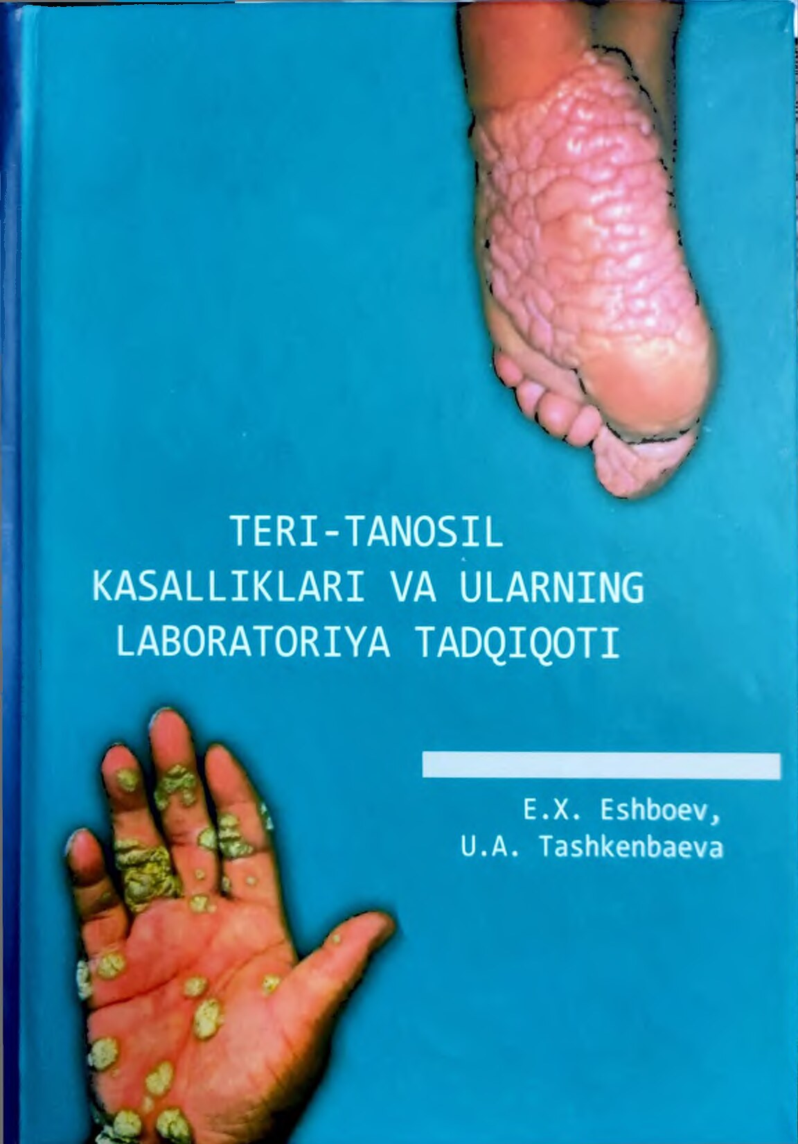 Teri tanosil kasalliklari va ularning laboratoriya tadqiqoti