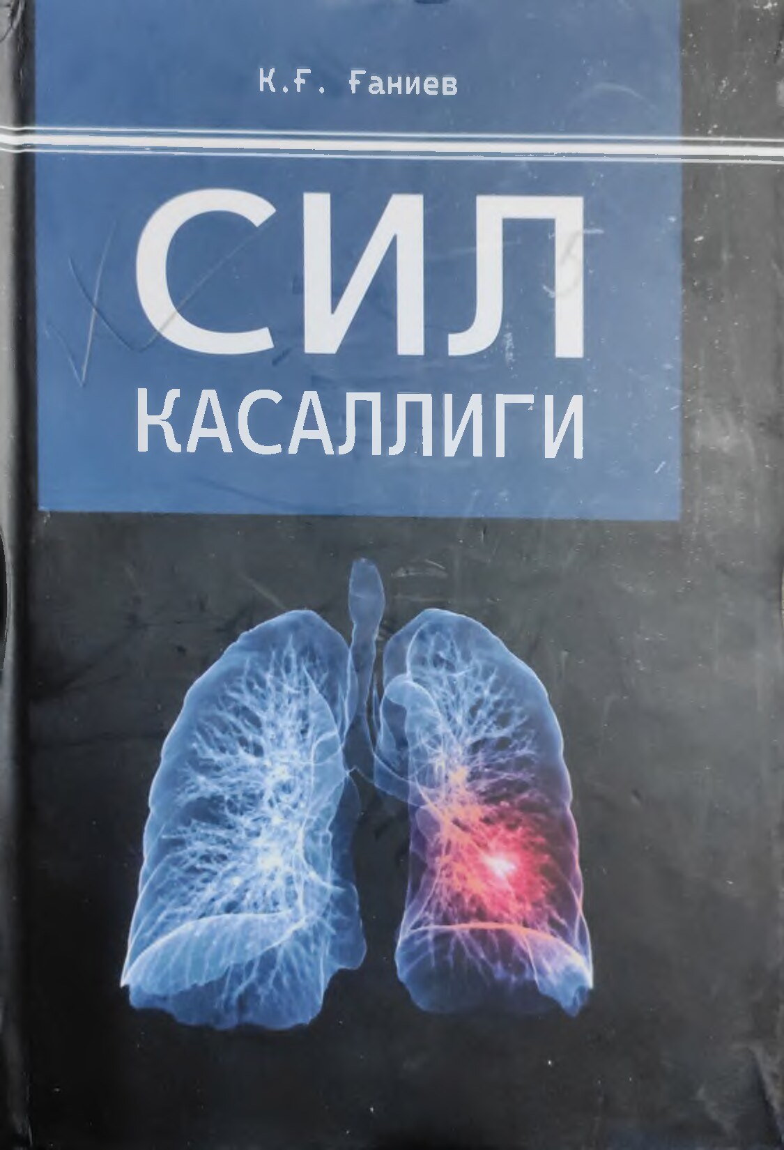 Sil -kasalligi- Ganiyev-K-G