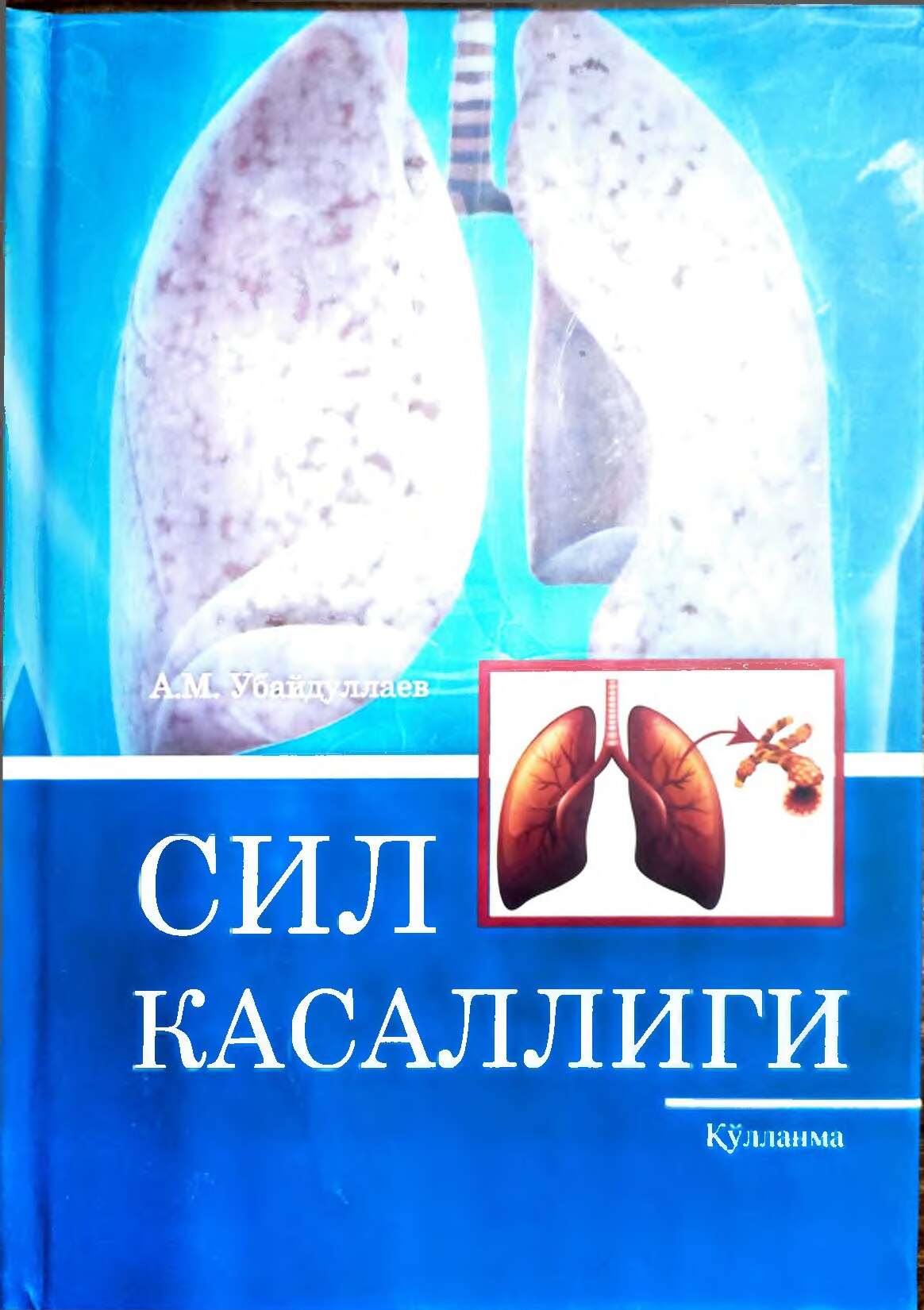 Сил касаллиги