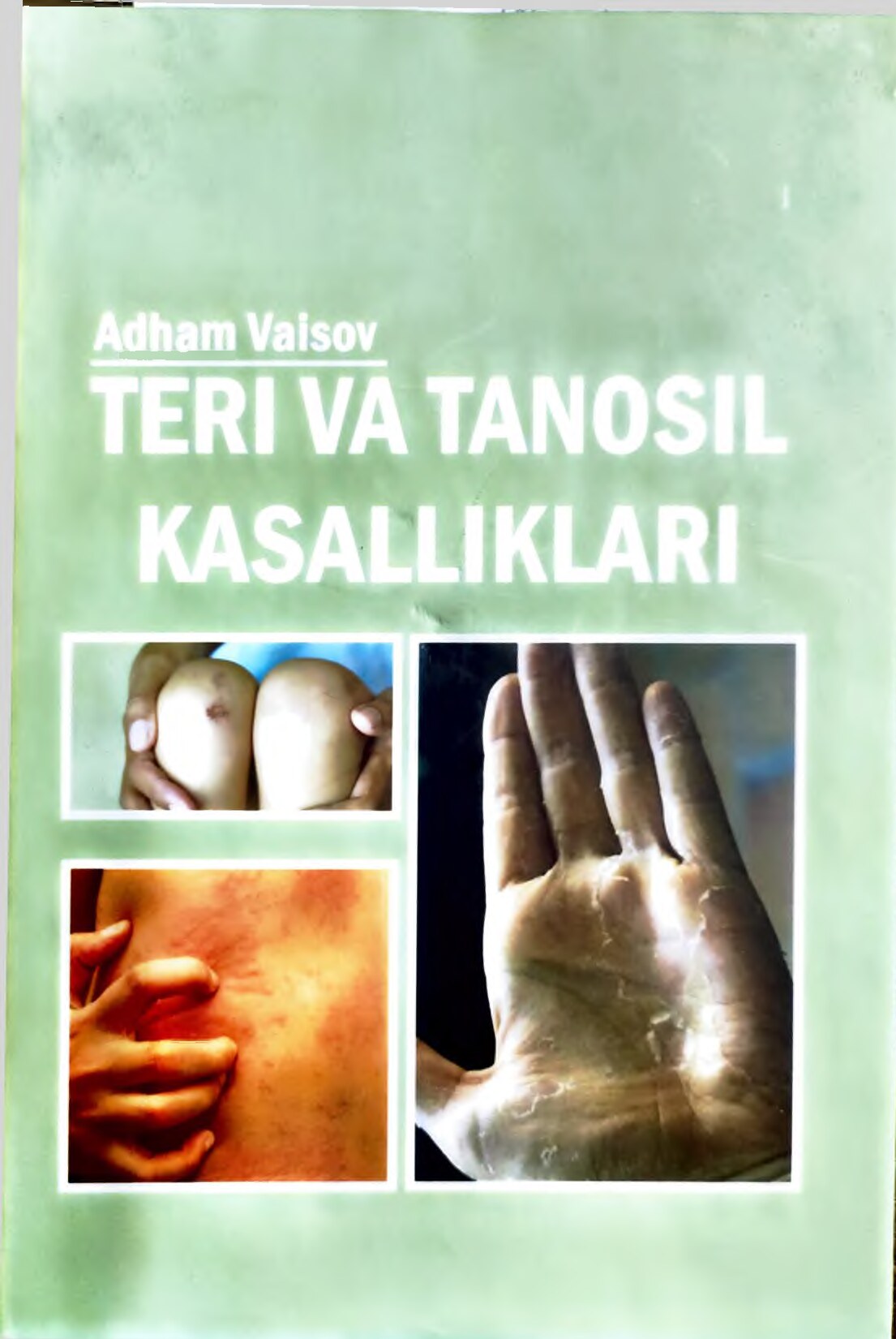 Тери ва таносил касалликлари