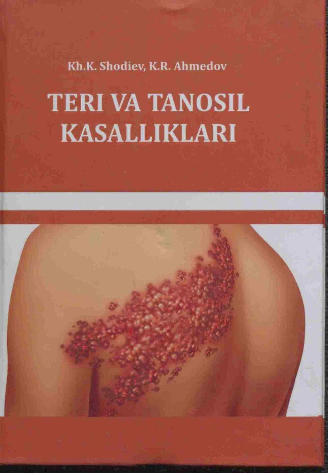 Teri vatanosil kasalliklari